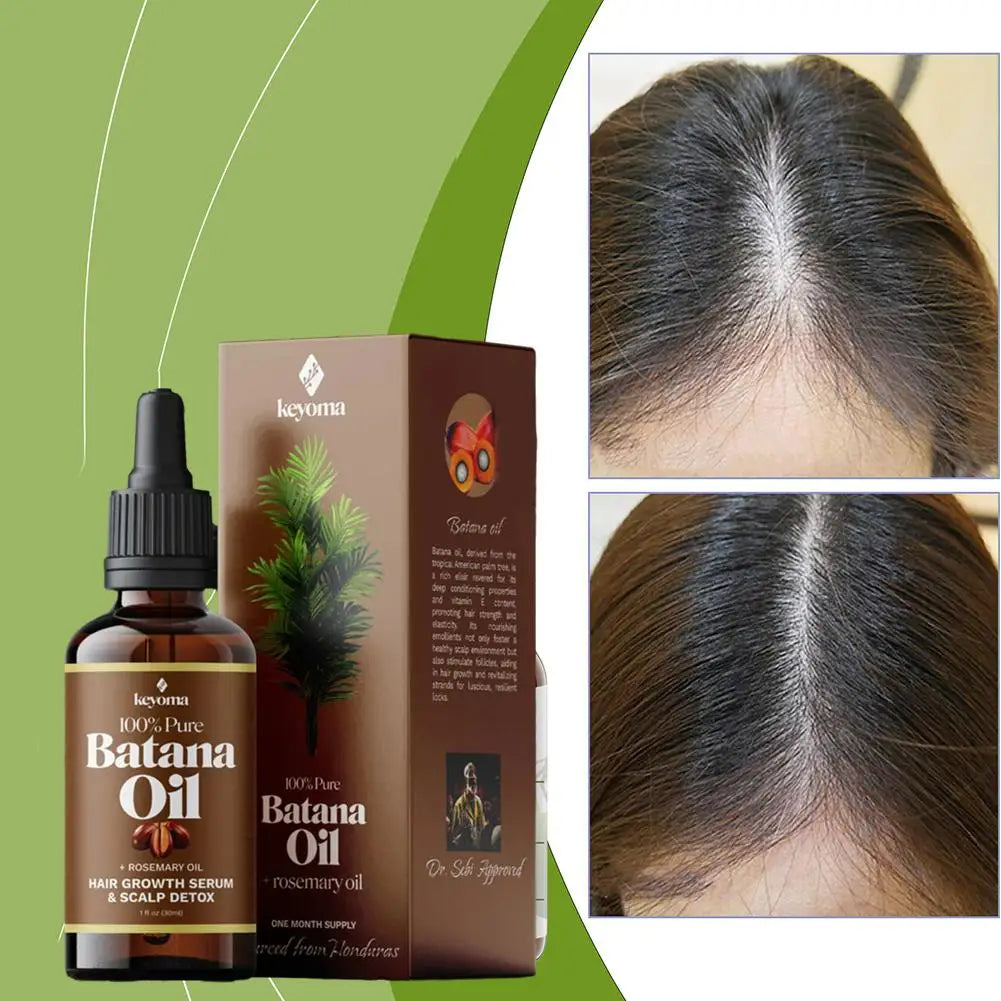 Batana Rosemary Hair Growth Oil