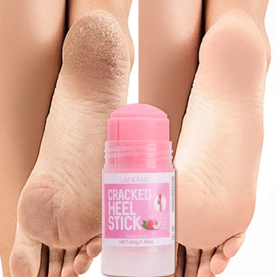 Cracked Heel Repair Stick Deep Moisturizing Foot Balm
